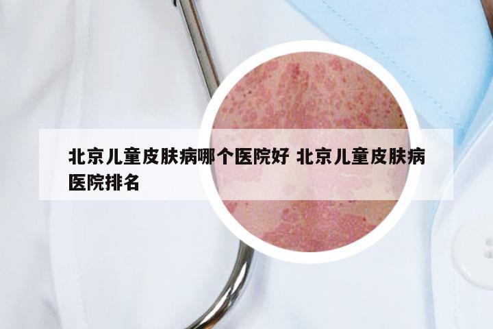 北京儿童皮肤病哪个医院好 北京儿童皮肤病医院排名