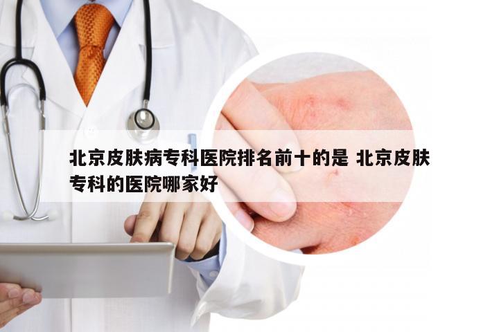 北京皮肤病专科医院排名前十的是 北京皮肤专科的医院哪家好