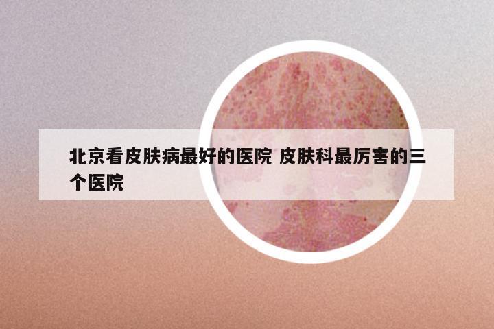 北京看皮肤病最好的医院 皮肤科最厉害的三个医院