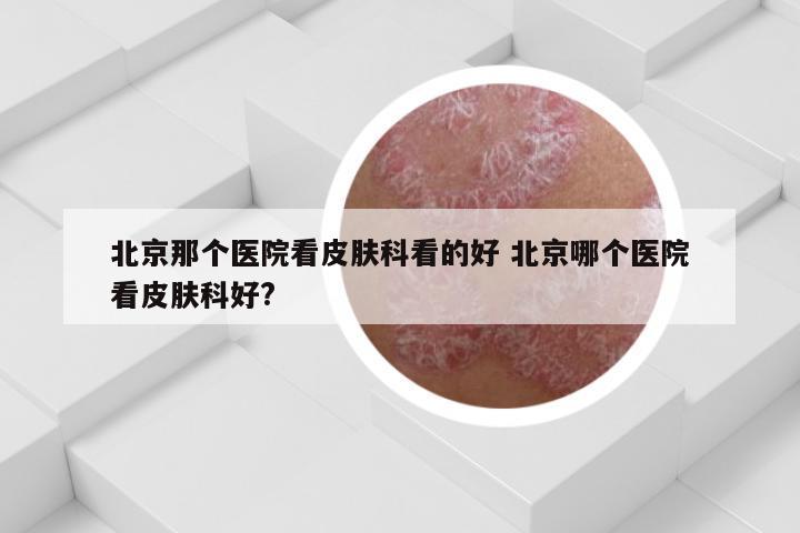 北京那个医院看皮肤科看的好 北京哪个医院看皮肤科好?