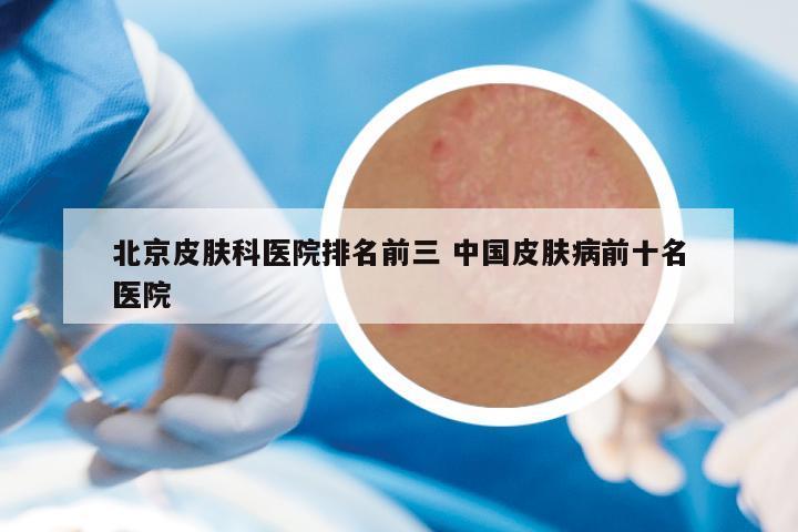 北京皮肤科医院排名前三 中国皮肤病前十名医院