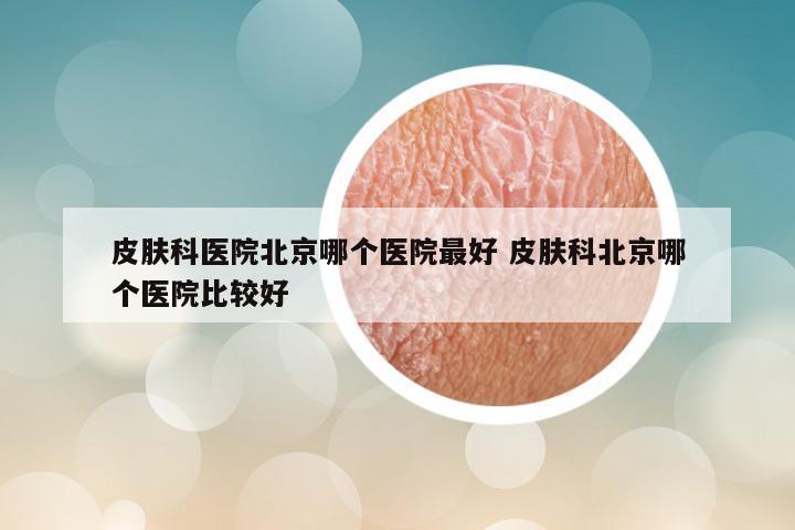 皮肤科医院北京哪个医院最好 皮肤科北京哪个医院比较好