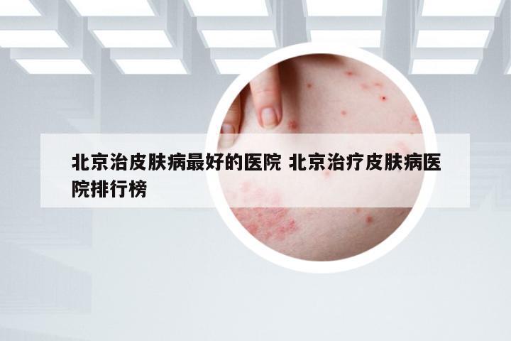 北京治皮肤病最好的医院 北京治疗皮肤病医院排行榜
