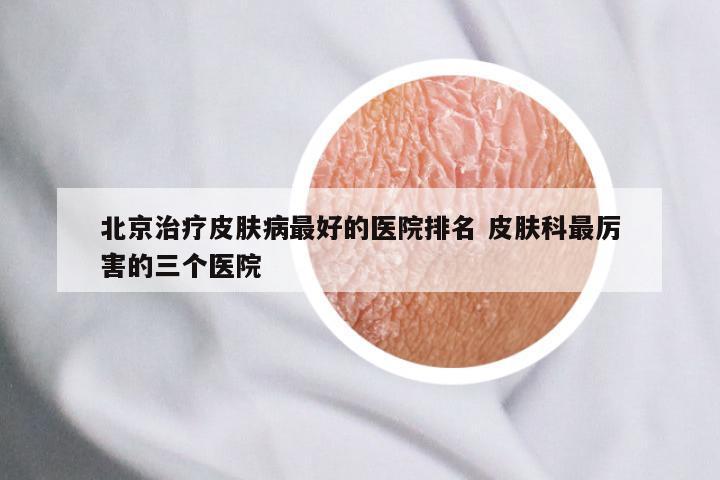 北京治疗皮肤病最好的医院排名 皮肤科最厉害的三个医院