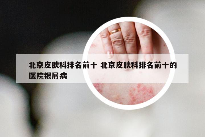 北京皮肤科排名前十 北京皮肤科排名前十的医院银屑病
