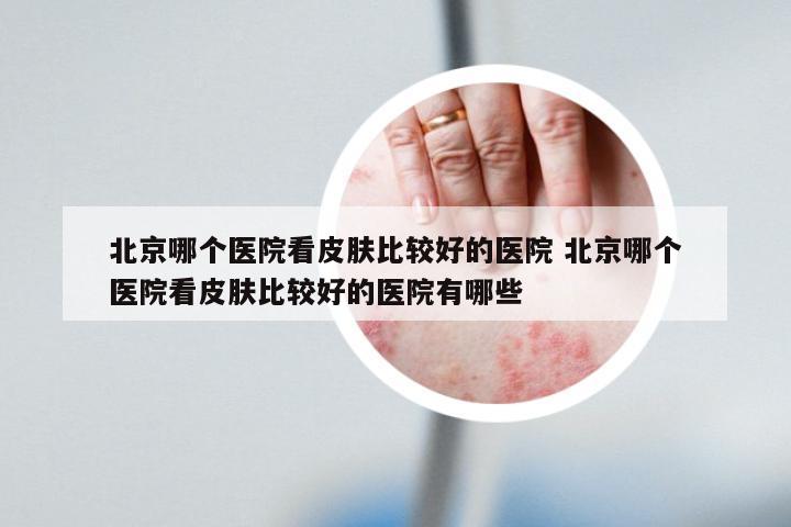 北京哪个医院看皮肤比较好的医院 北京哪个医院看皮肤比较好的医院有哪些