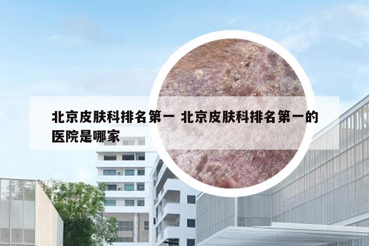 北京皮肤科排名第一 北京皮肤科排名第一的医院是哪家