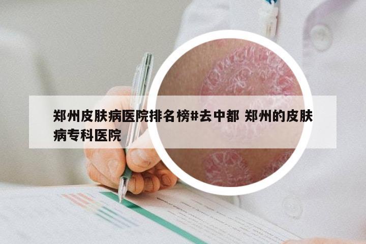 郑州皮肤病医院排名榜#去中都 郑州的皮肤病专科医院