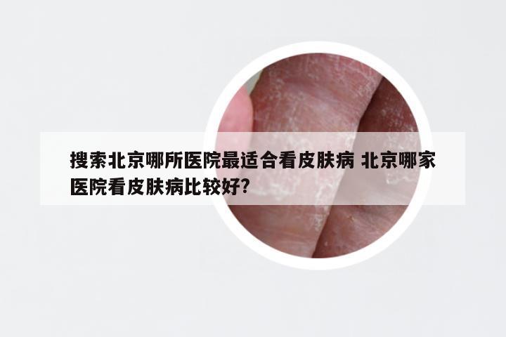 搜索北京哪所医院最适合看皮肤病 北京哪家医院看皮肤病比较好?