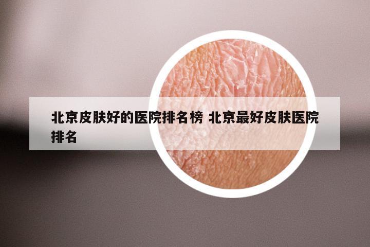 北京皮肤好的医院排名榜 北京最好皮肤医院排名