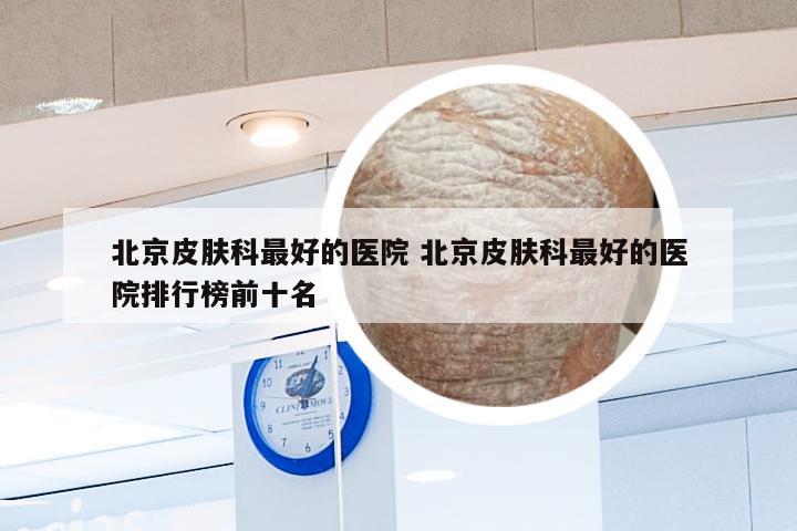 北京皮肤科最好的医院 北京皮肤科最好的医院排行榜前十名
