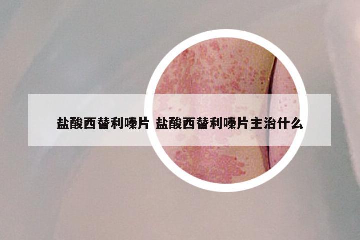 盐酸西替利嗪片 盐酸西替利嗪片主治什么
