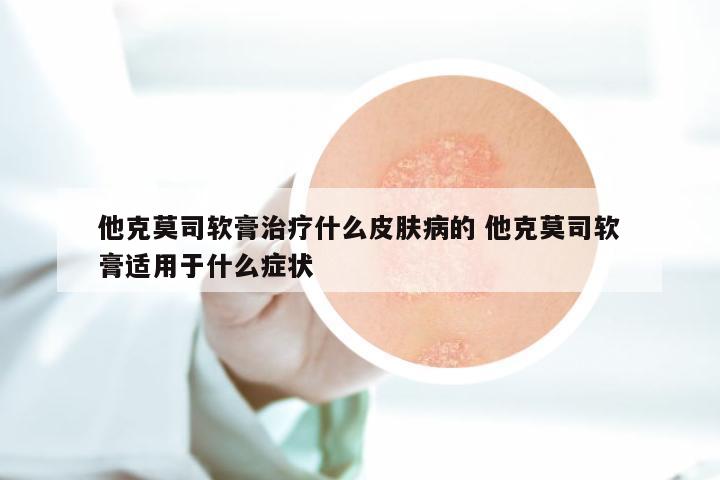 他克莫司软膏治疗什么皮肤病的 他克莫司软膏适用于什么症状