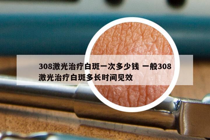 308激光治疗白斑一次多少钱 一般308激光治疗白斑多长时间见效