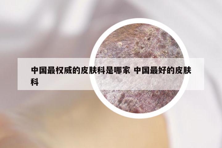 中国最权威的皮肤科是哪家 中国最好的皮肤科