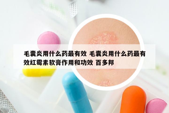 毛囊炎用什么药最有效 毛囊炎用什么药最有效红霉素软膏作用和功效 百多邦