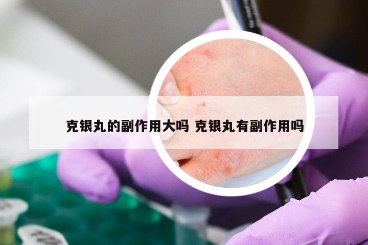 克银丸的副作用大吗 克银丸有副作用吗