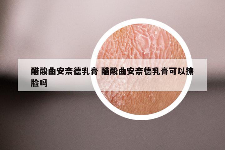 醋酸曲安奈德乳膏 醋酸曲安奈德乳膏可以擦脸吗