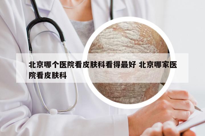 北京哪个医院看皮肤科看得最好 北京哪家医院看皮肤科