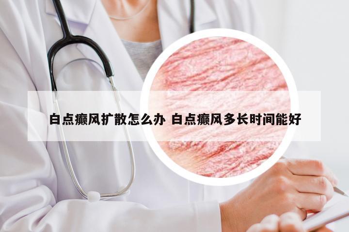 白点癫风扩散怎么办 白点癫风多长时间能好