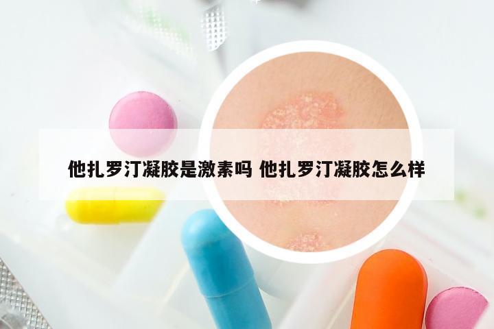 他扎罗汀凝胶是激素吗 他扎罗汀凝胶怎么样