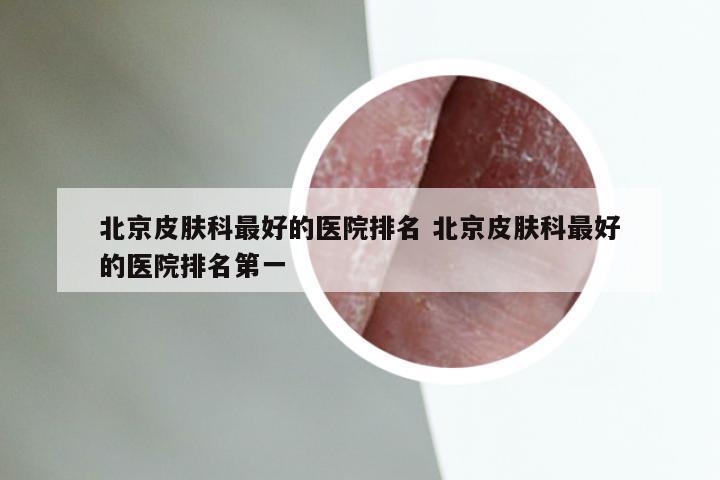 北京皮肤科最好的医院排名 北京皮肤科最好的医院排名第一