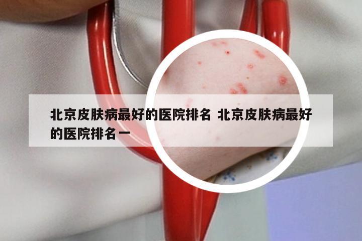 北京皮肤病最好的医院排名 北京皮肤病最好的医院排名一