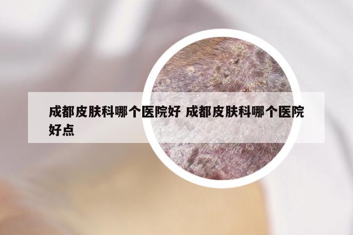 成都皮肤科哪个医院好 成都皮肤科哪个医院好点