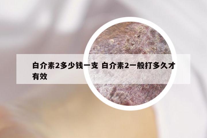 白介素2多少钱一支 白介素2一般打多久才有效