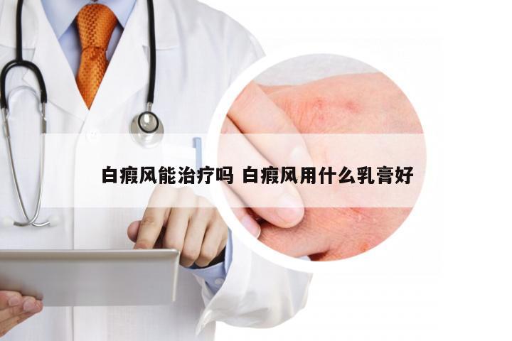 白瘕风能治疗吗 白瘕风用什么乳膏好