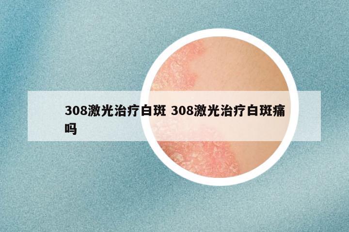 308激光治疗白斑 308激光治疗白斑痛吗