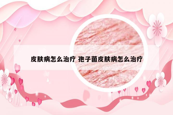 皮肤病怎么治疗 孢子菌皮肤病怎么治疗