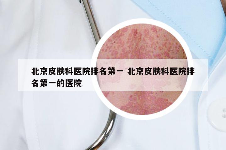 北京皮肤科医院排名第一 北京皮肤科医院排名第一的医院