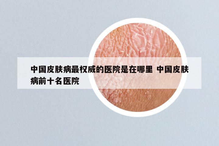 中国皮肤病最权威的医院是在哪里 中国皮肤病前十名医院