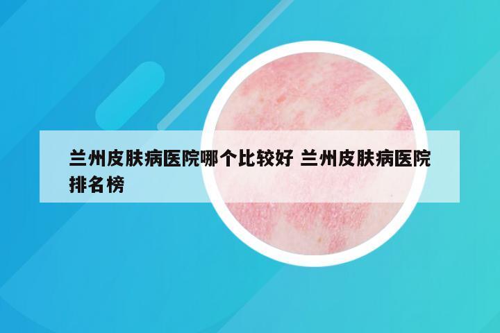 兰州皮肤病医院哪个比较好 兰州皮肤病医院排名榜