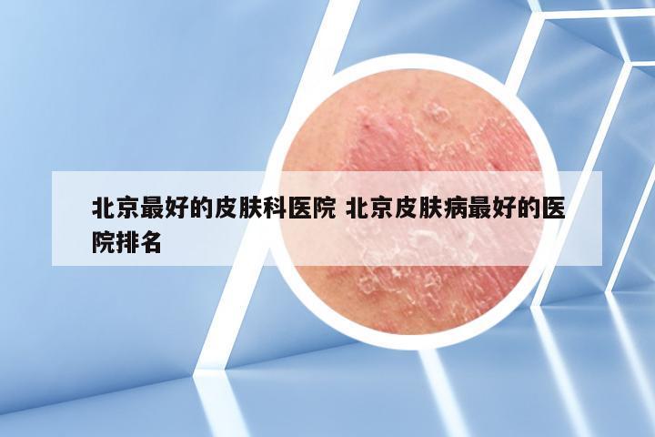 北京最好的皮肤科医院 北京皮肤病最好的医院排名