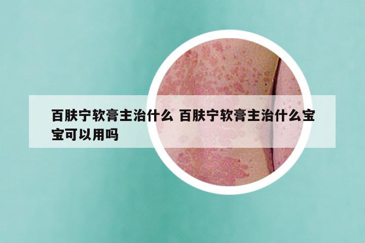 百肤宁软膏主治什么 百肤宁软膏主治什么宝宝可以用吗