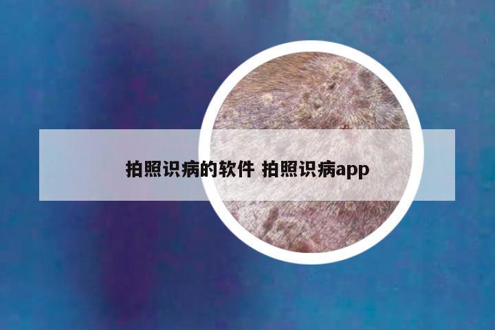 拍照识病的软件 拍照识病app