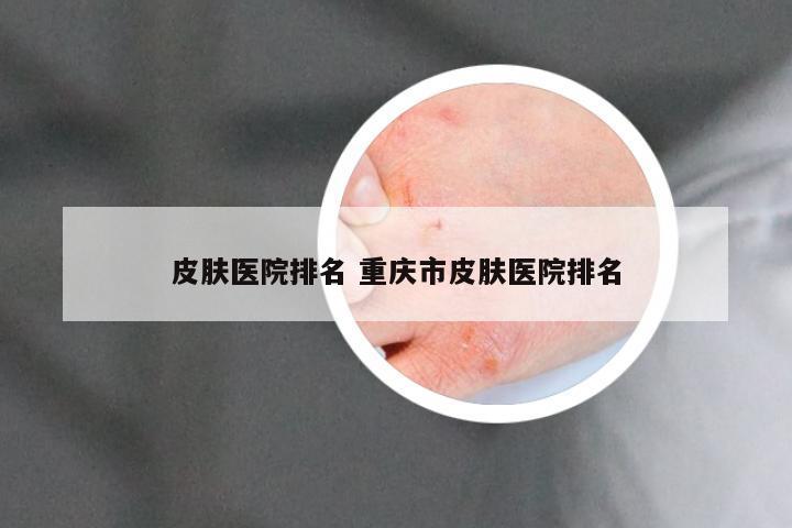 皮肤医院排名 重庆市皮肤医院排名