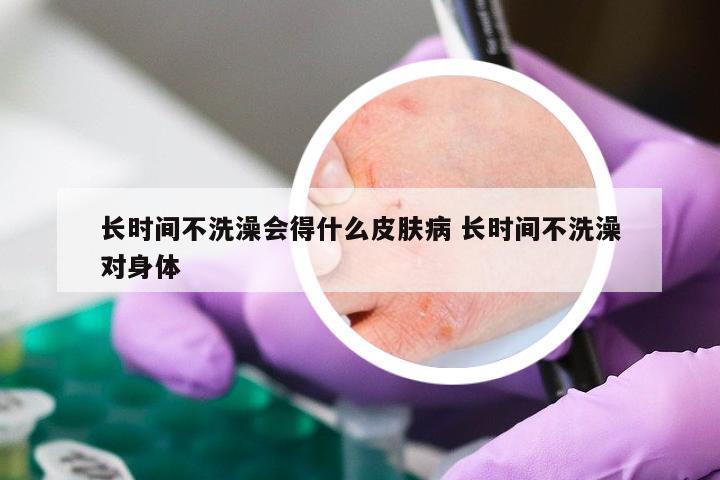 长时间不洗澡会得什么皮肤病 长时间不洗澡对身体