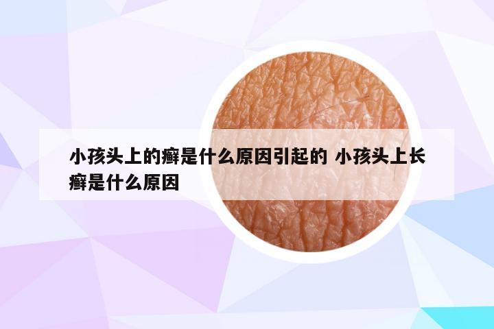 小孩头上的癣是什么原因引起的 小孩头上长癣是什么原因