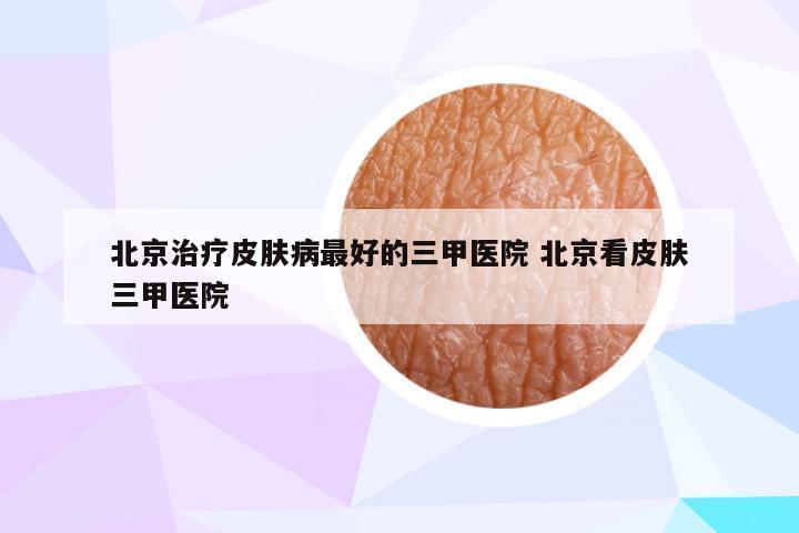 北京治疗皮肤病最好的三甲医院 北京看皮肤三甲医院