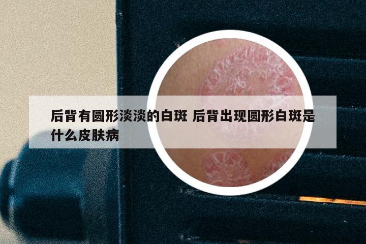 后背有圆形淡淡的白斑 后背出现圆形白斑是什么皮肤病