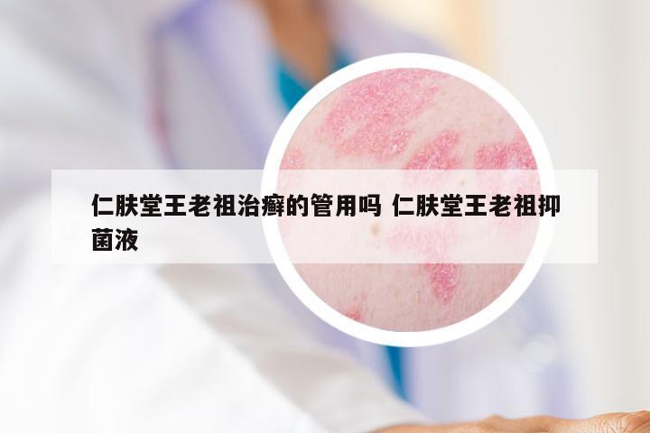 仁肤堂王老祖治癣的管用吗 仁肤堂王老祖抑菌液