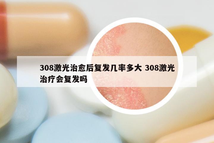 308激光治愈后复发几率多大 308激光治疗会复发吗