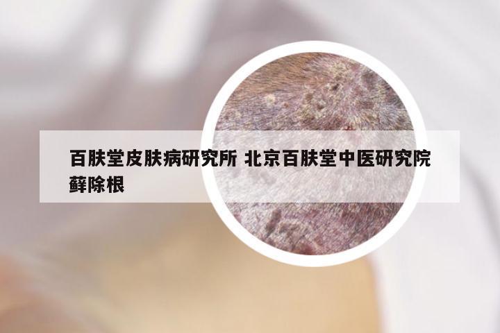 百肤堂皮肤病研究所 北京百肤堂中医研究院藓除根