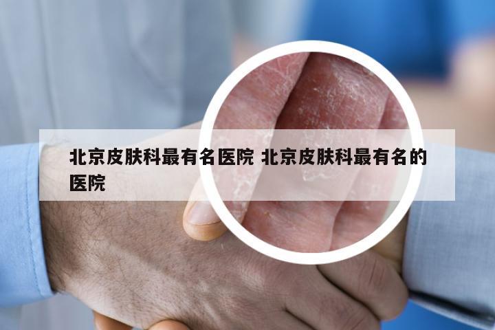 北京皮肤科最有名医院 北京皮肤科最有名的医院