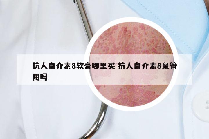 抗人白介素8软膏哪里买 抗人白介素8鼠管用吗