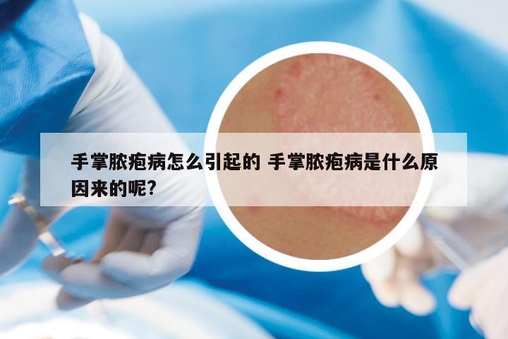 手掌脓疱病怎么引起的 手掌脓疱病是什么原因来的呢?