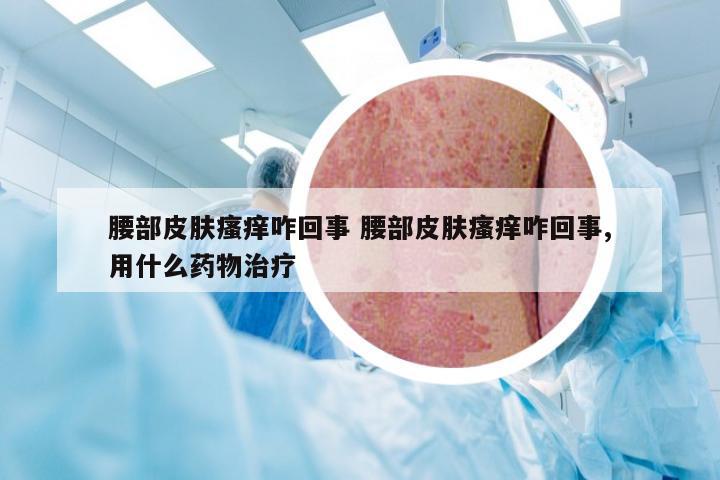 腰部皮肤瘙痒咋回事 腰部皮肤瘙痒咋回事,用什么药物治疗